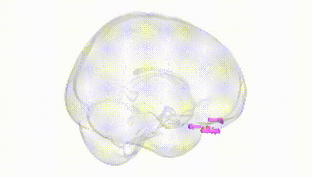 Full Brain White