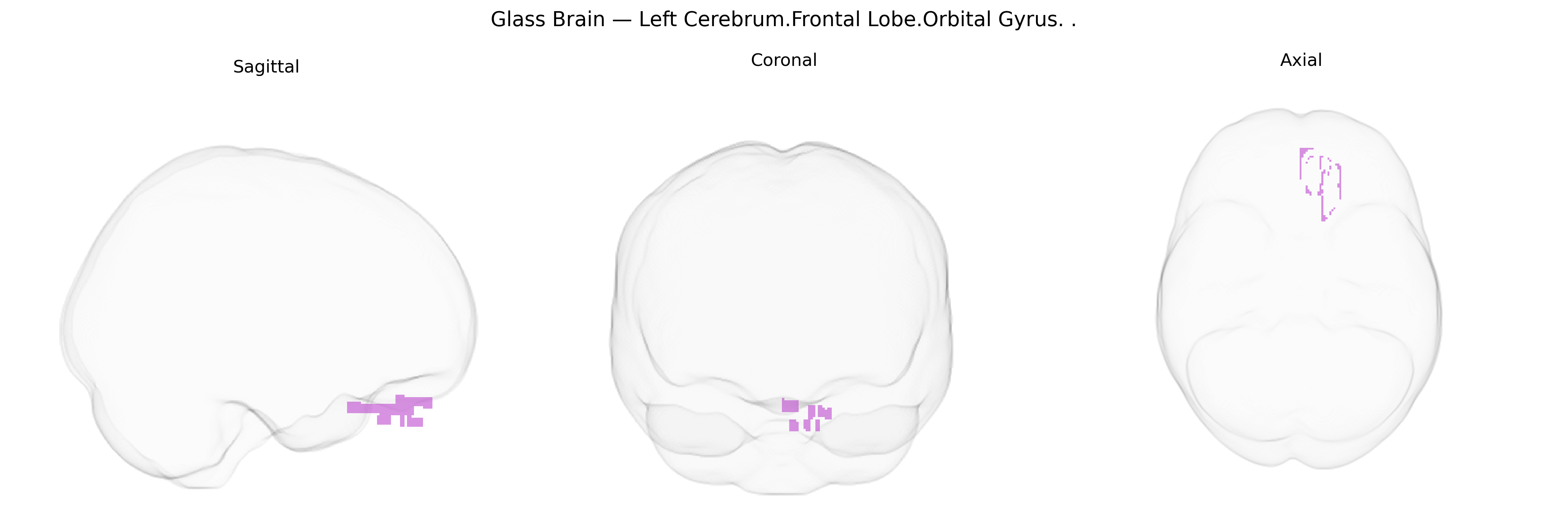 Triplanar Ghost Brain