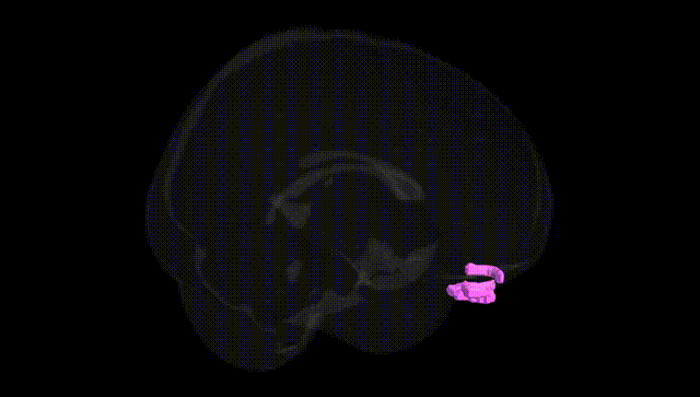 Full Brain Black