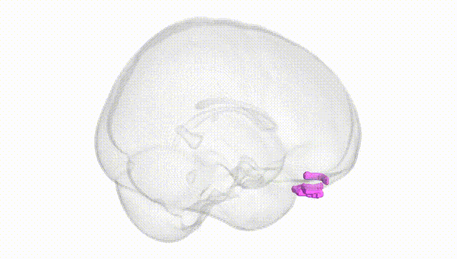 Full Brain White
