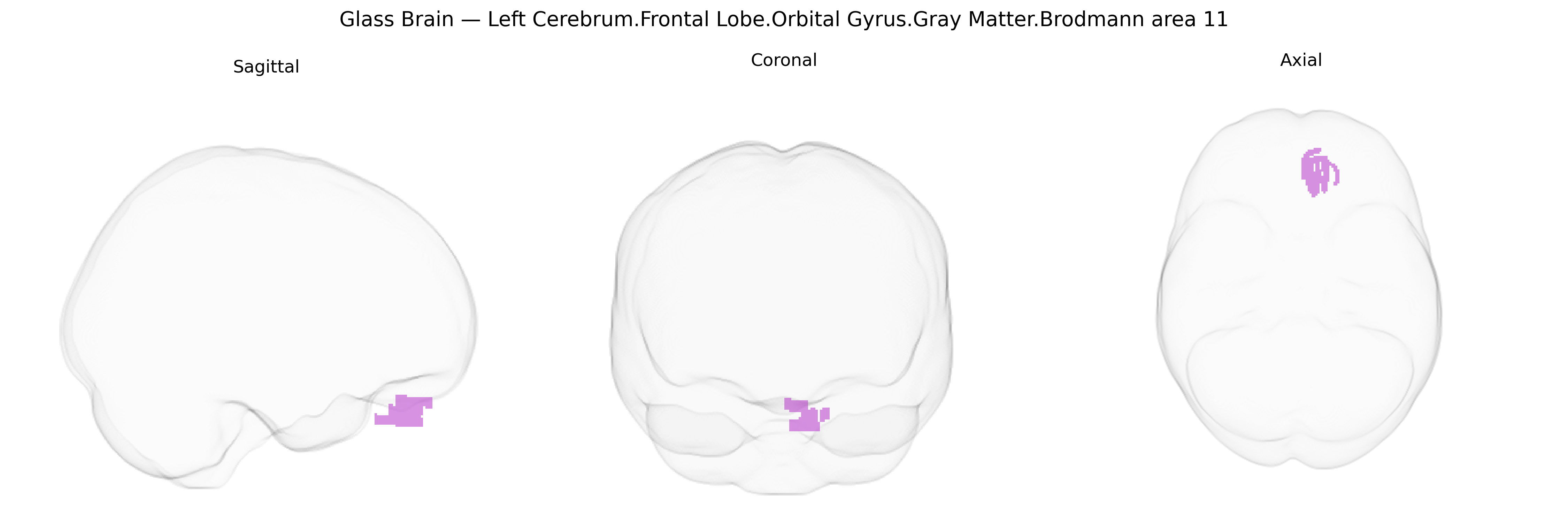 Triplanar Ghost Brain