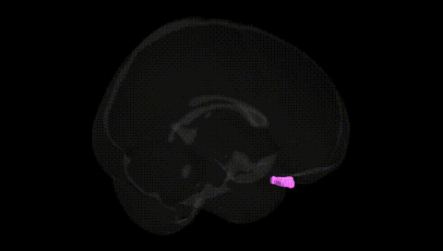 Full Brain Black