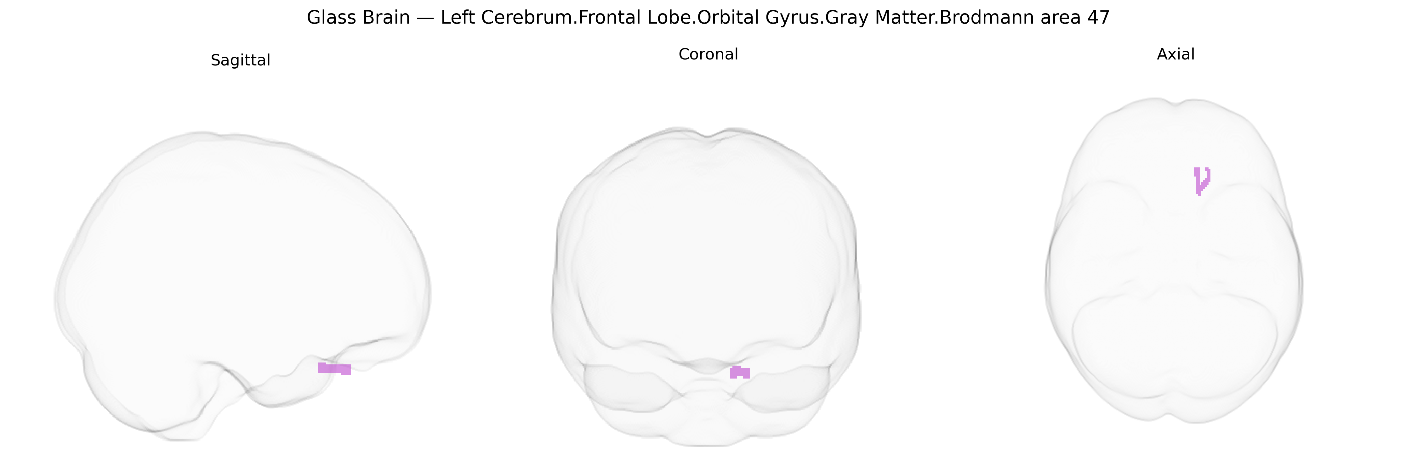 Triplanar Ghost Brain