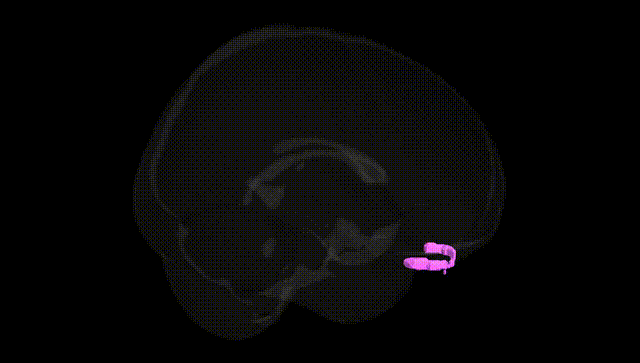 Full Brain Black