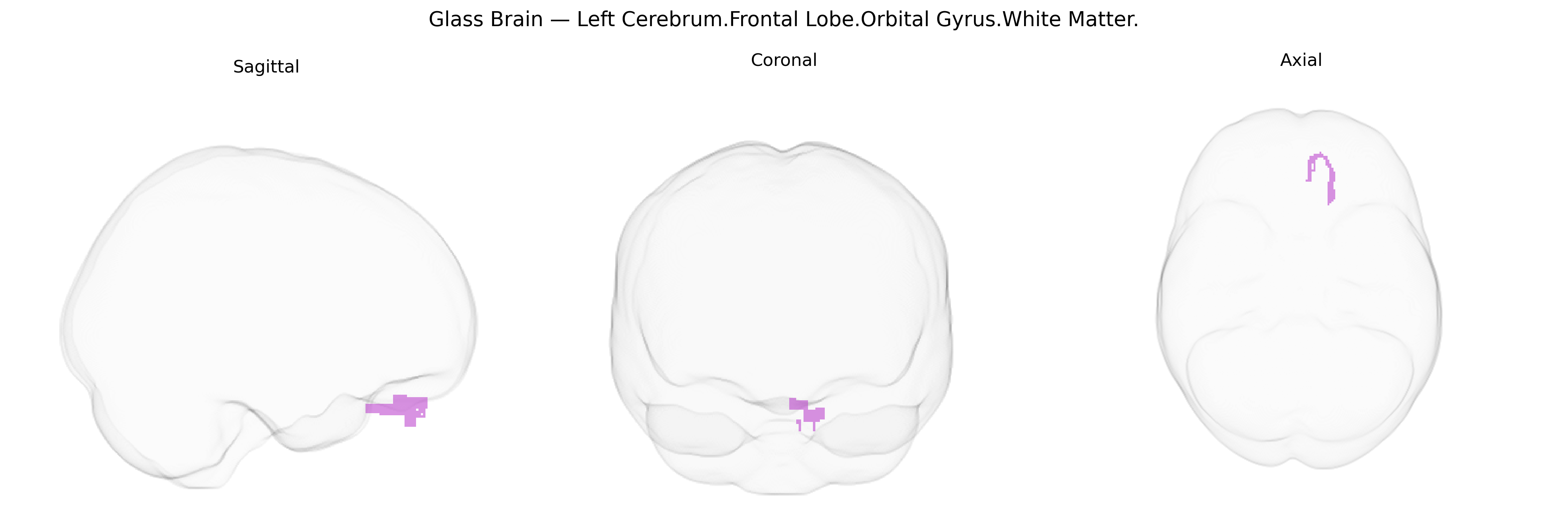 Triplanar Ghost Brain