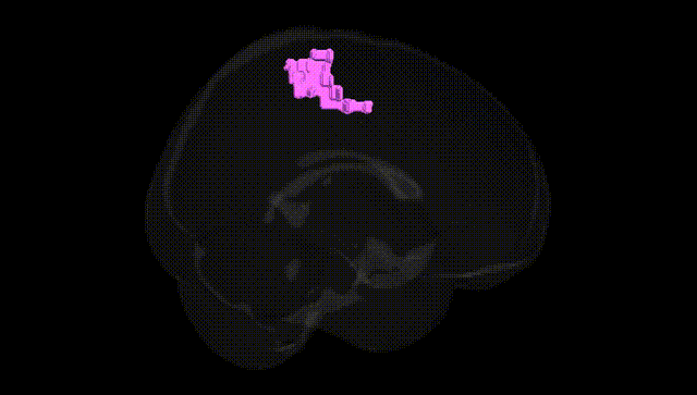 Full Brain Black