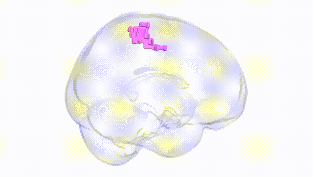 Full Brain White