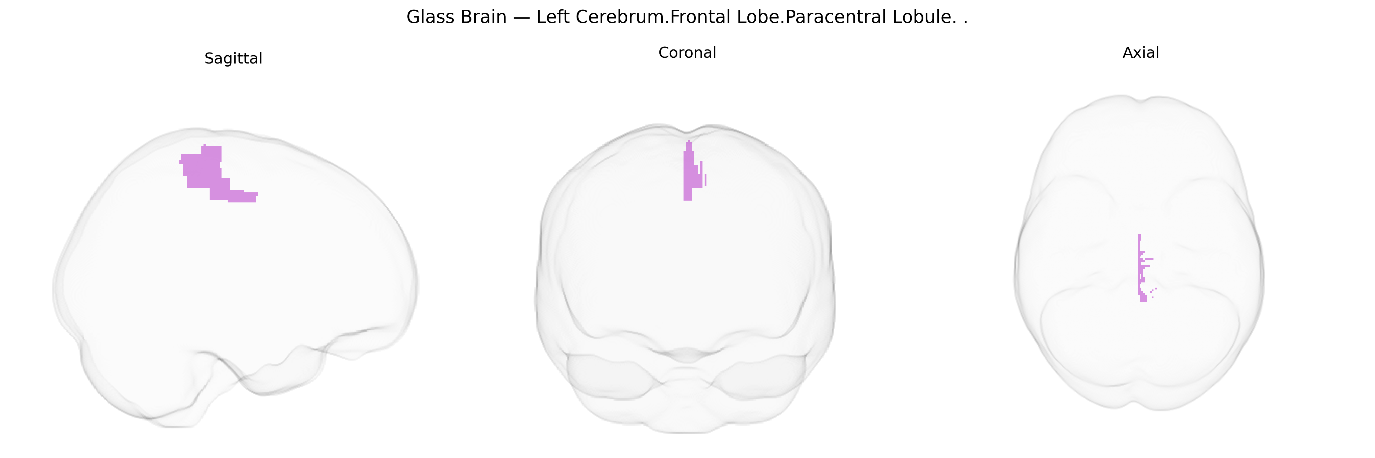 Triplanar Ghost Brain