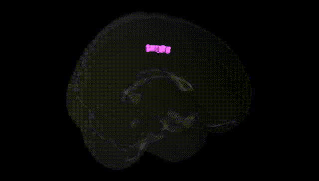Full Brain Black