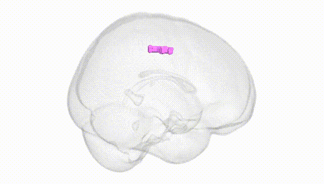 Full Brain White