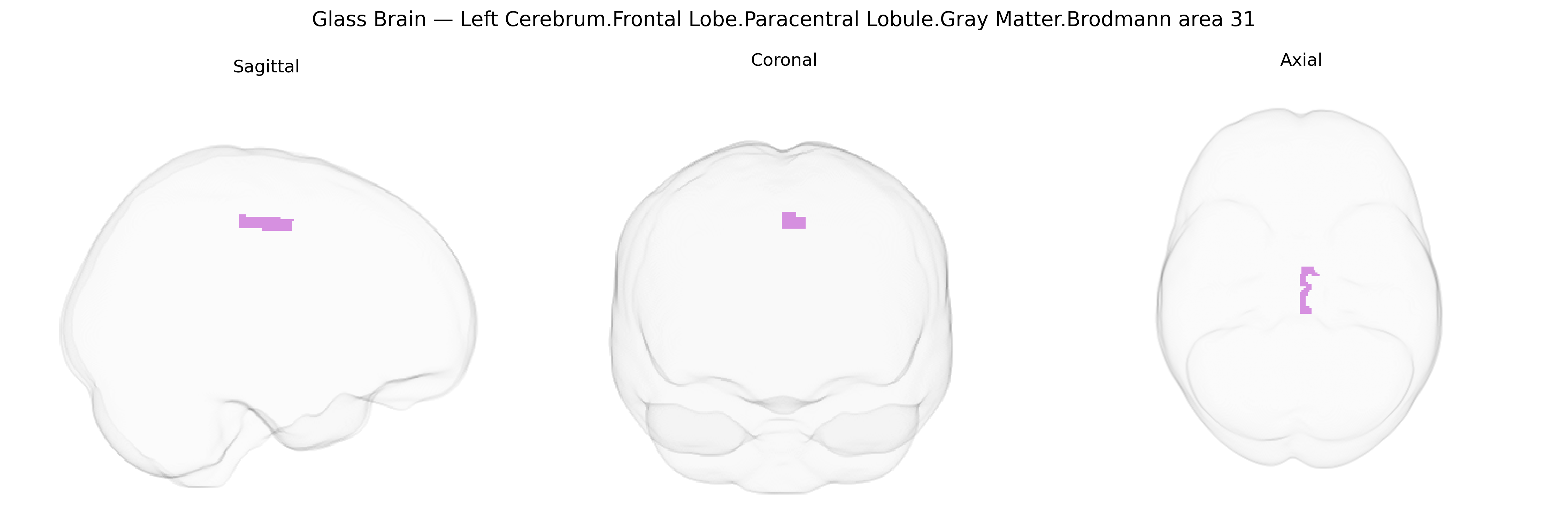 Triplanar Ghost Brain