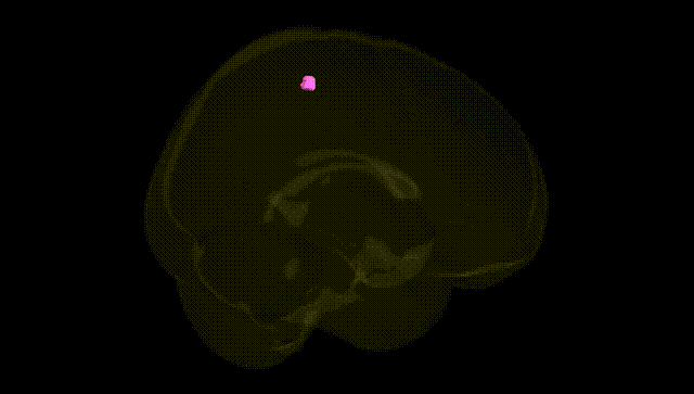 Full Brain Black