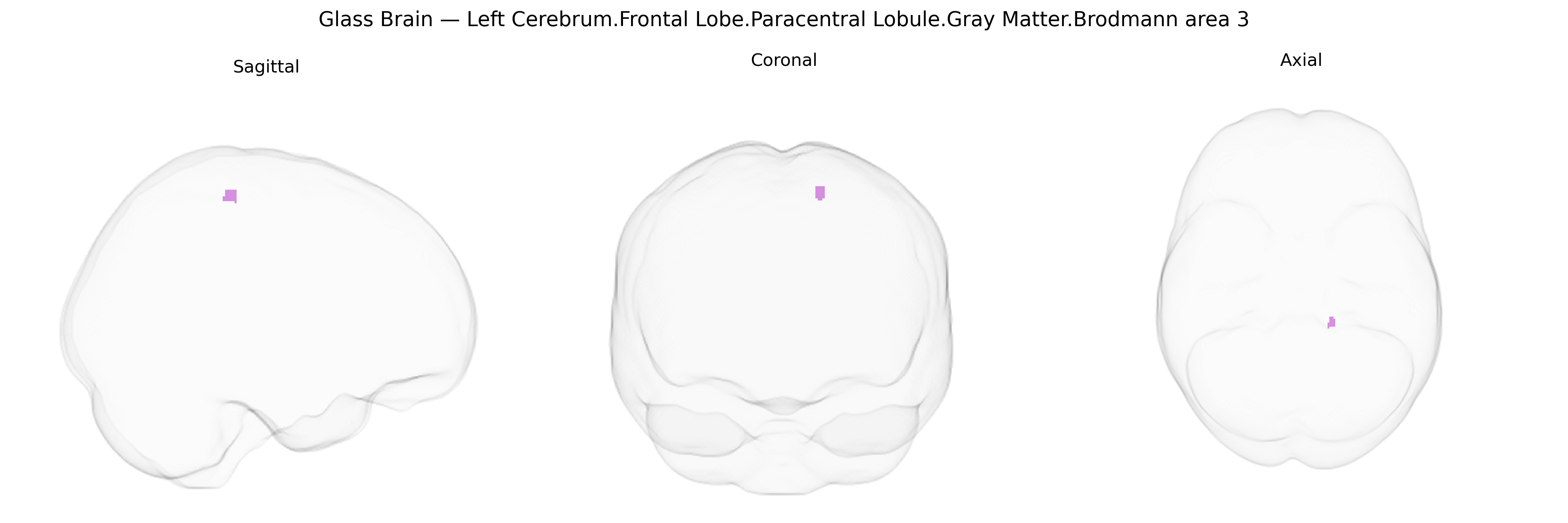 Triplanar Ghost Brain