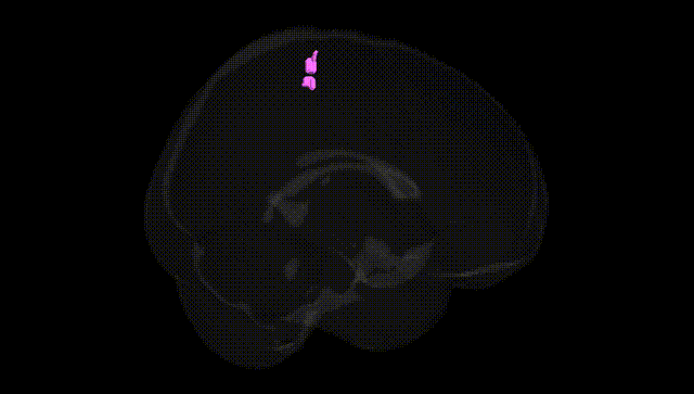 Full Brain Black
