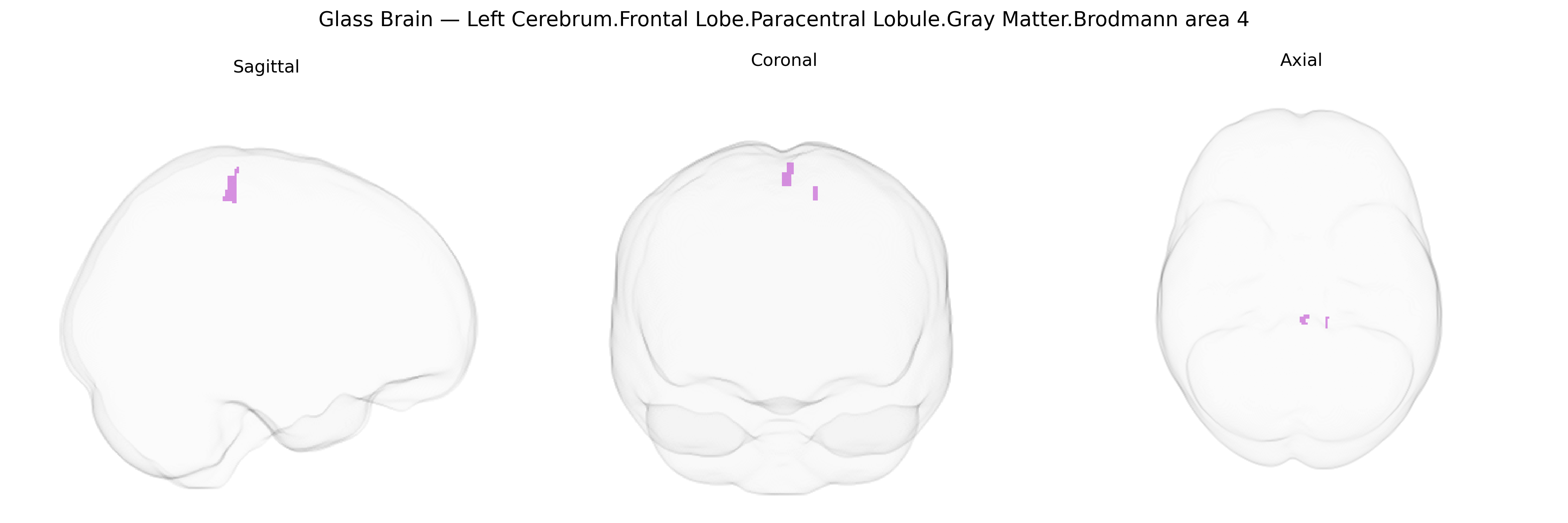 Triplanar Ghost Brain