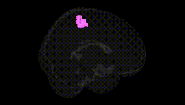 Full Brain Black