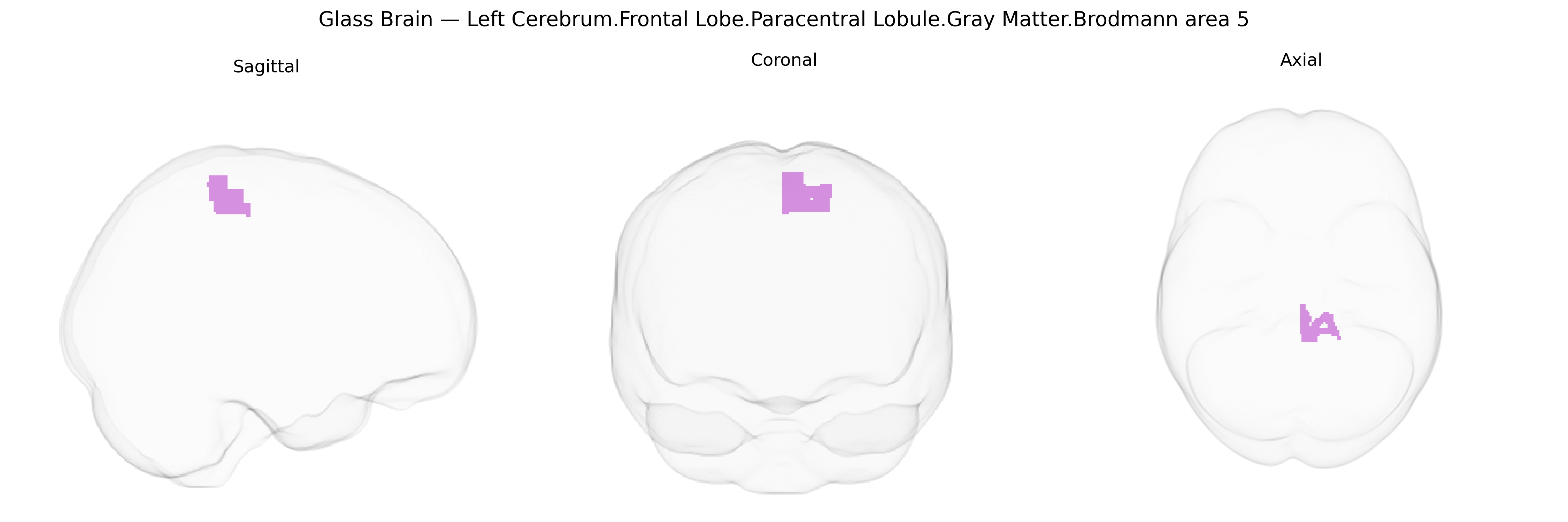 Triplanar Ghost Brain