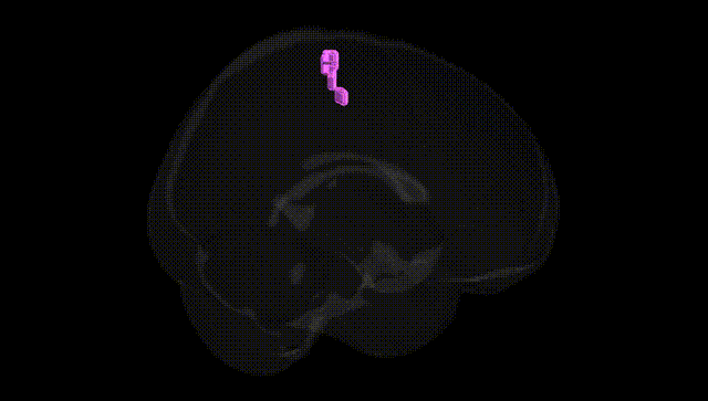 Full Brain Black