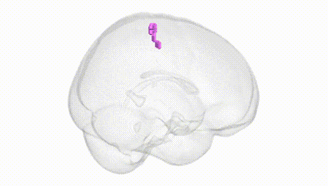 Full Brain White