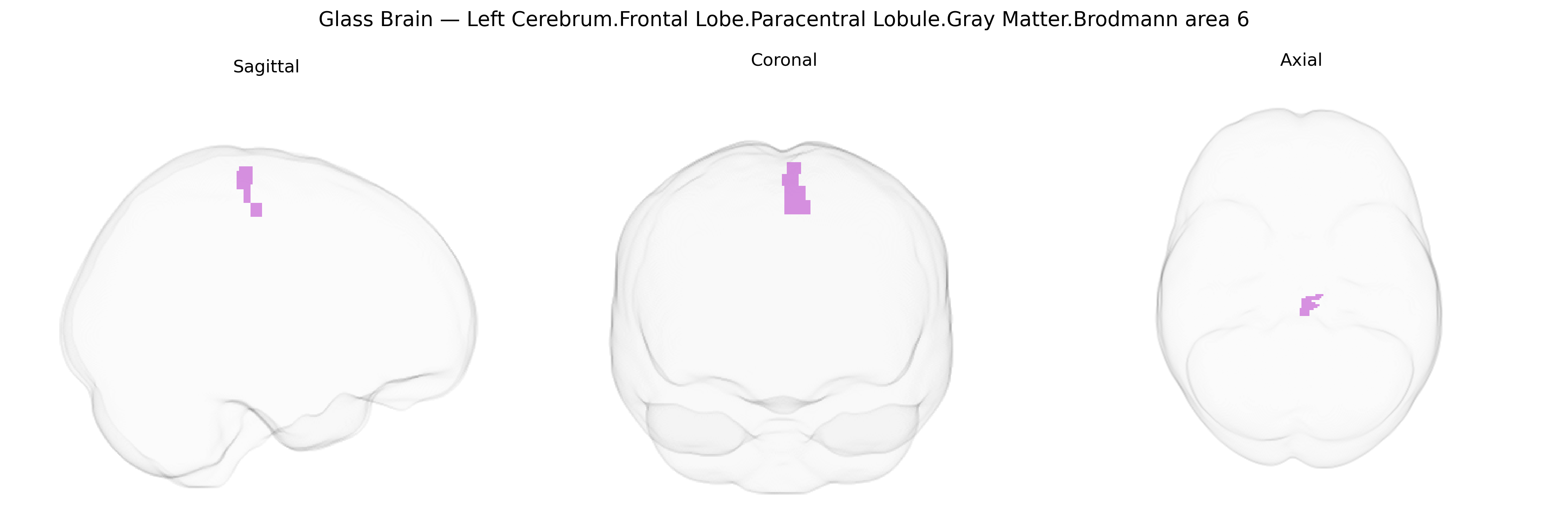 Triplanar Ghost Brain