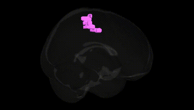 Full Brain Black