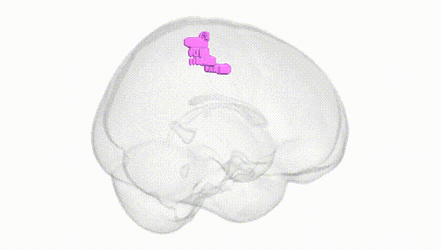 Full Brain White