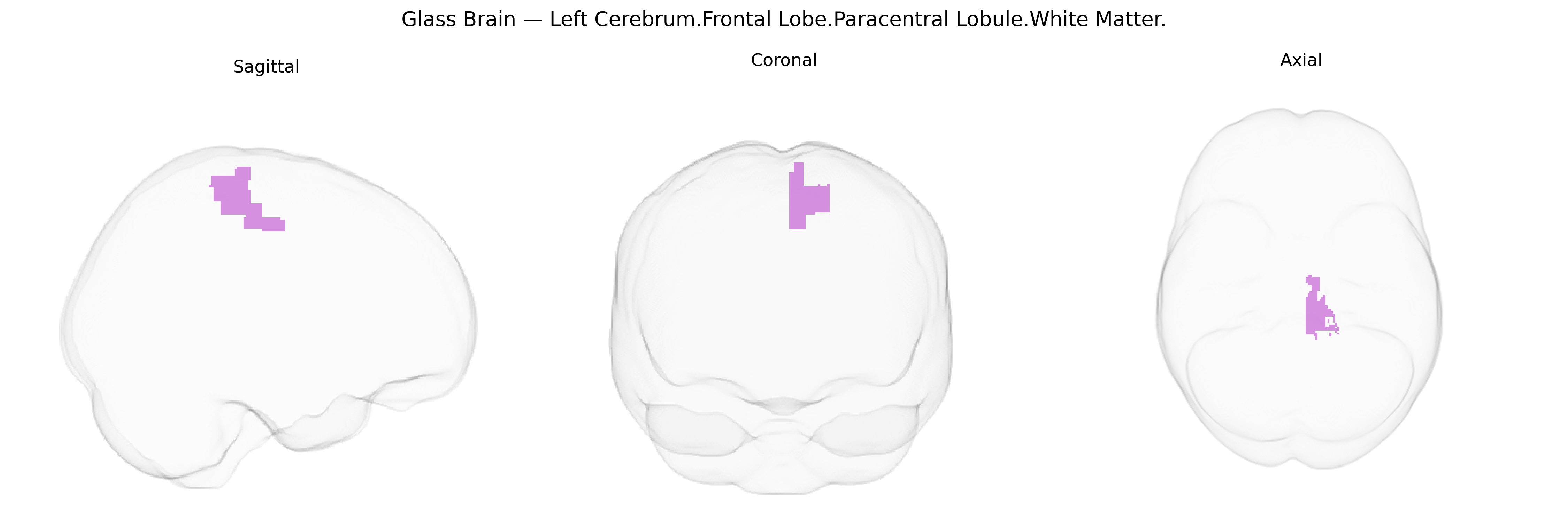Triplanar Ghost Brain