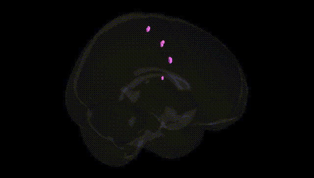 Full Brain Black