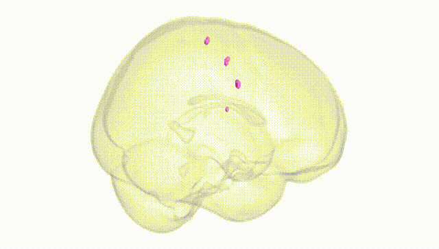 Full Brain White