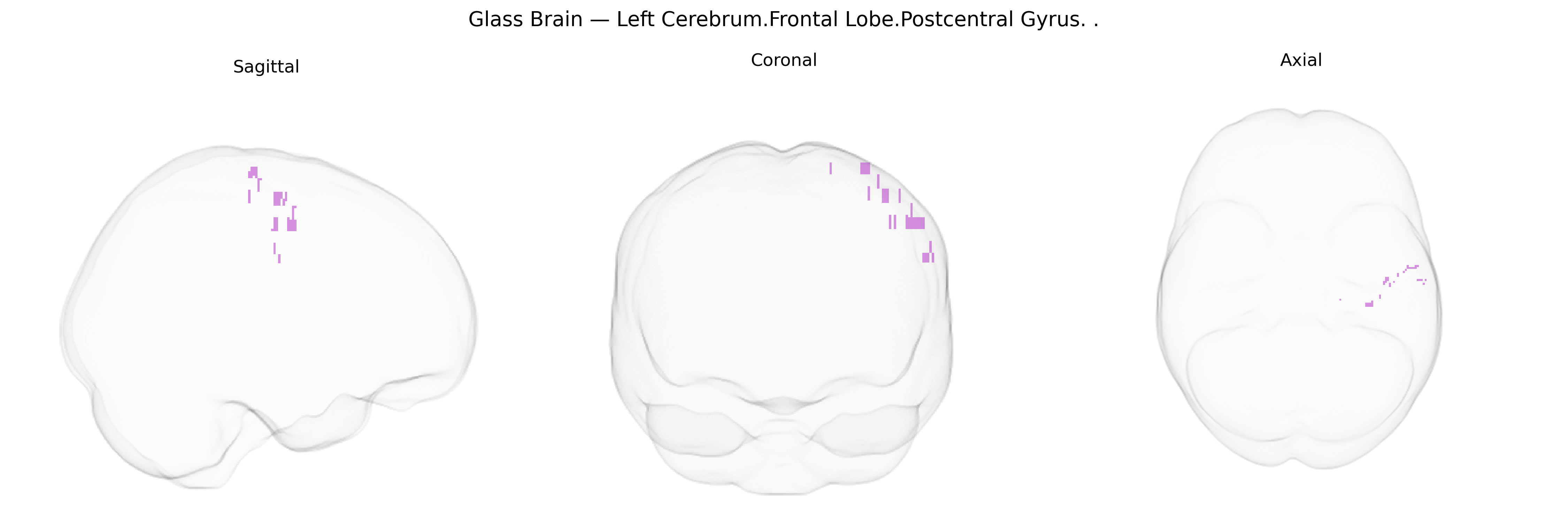 Triplanar Ghost Brain