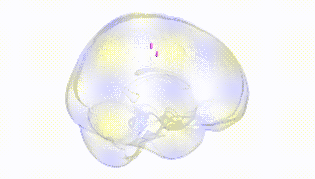 Full Brain White