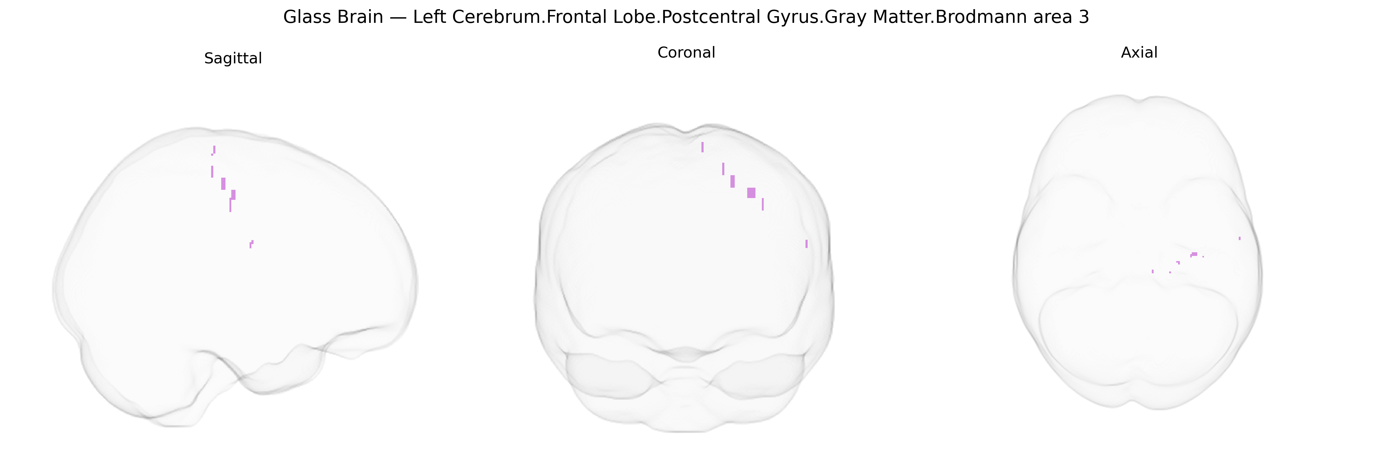 Triplanar Ghost Brain