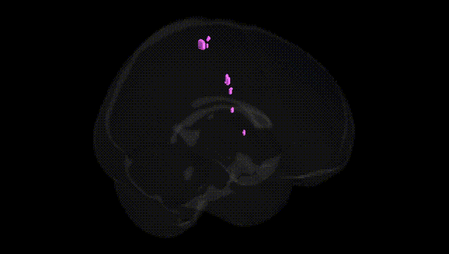 Full Brain Black