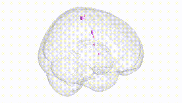 Full Brain White