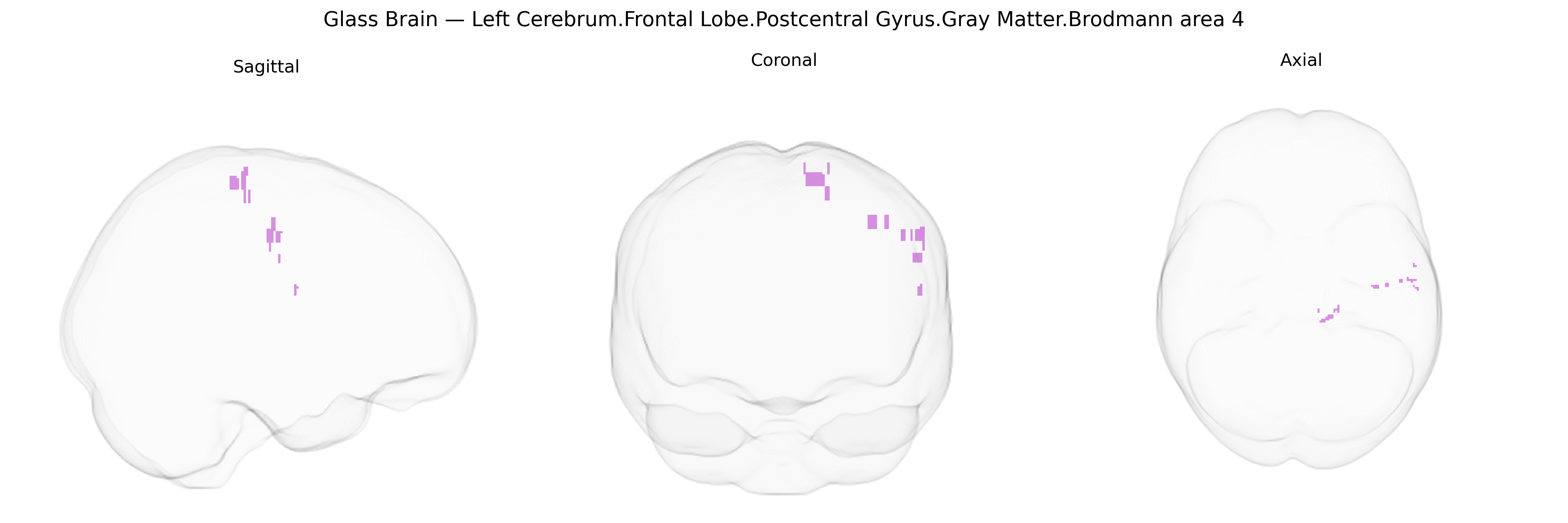 Triplanar Ghost Brain