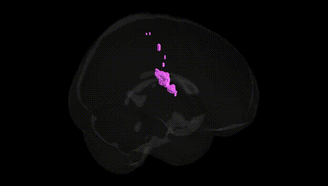 Full Brain Black