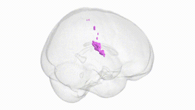 Full Brain White