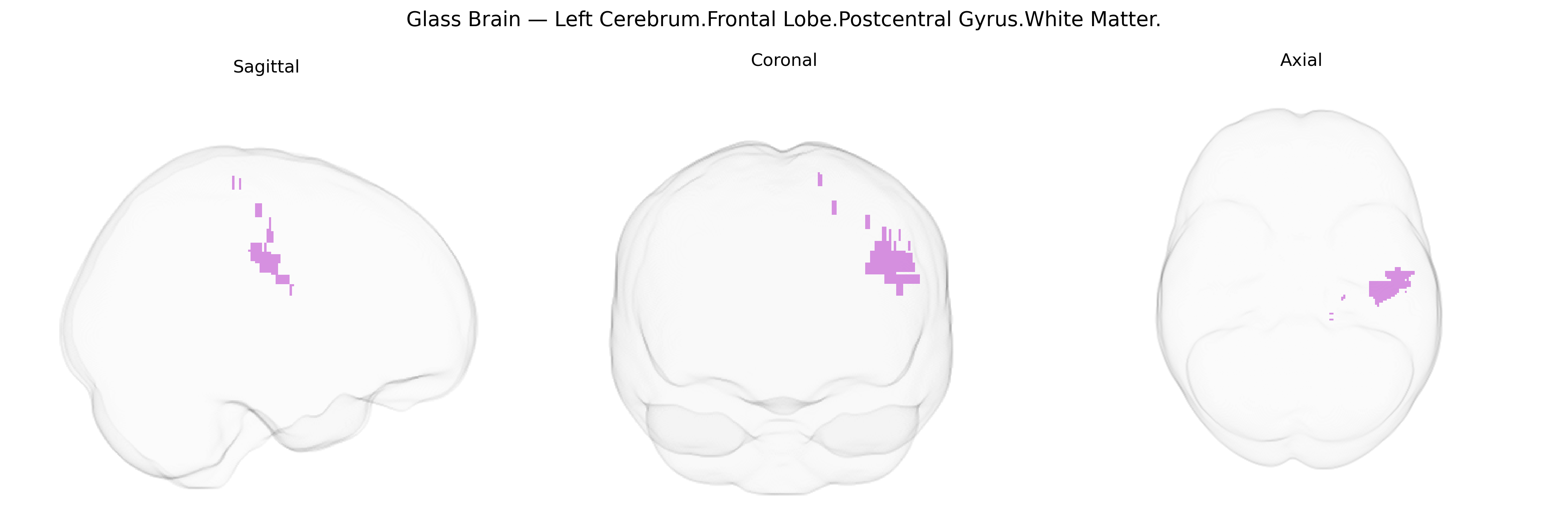 Triplanar Ghost Brain
