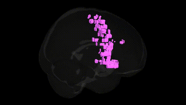 Full Brain Black