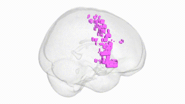 Full Brain White