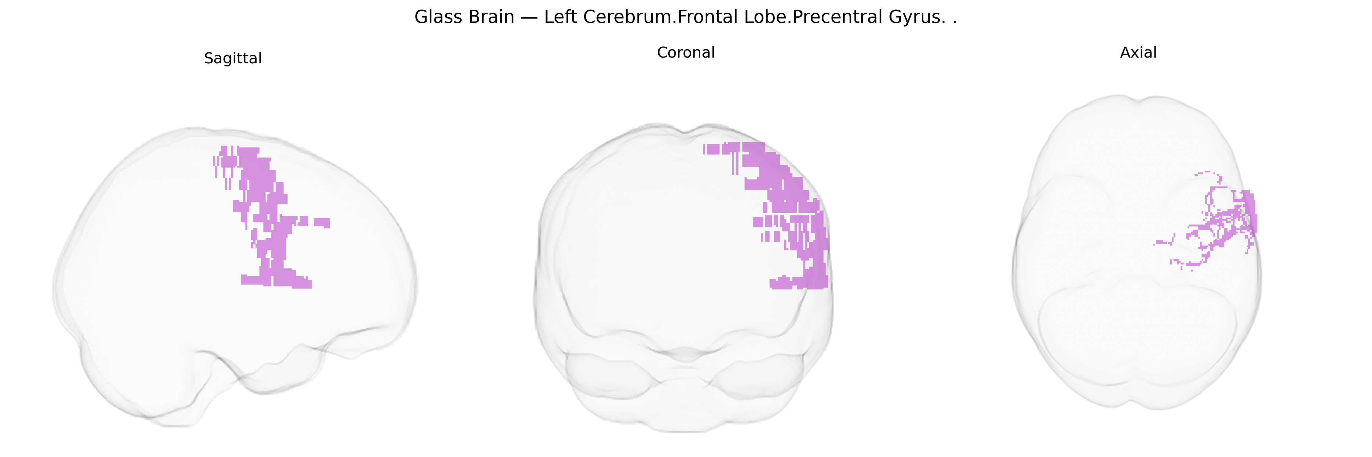 Triplanar Ghost Brain