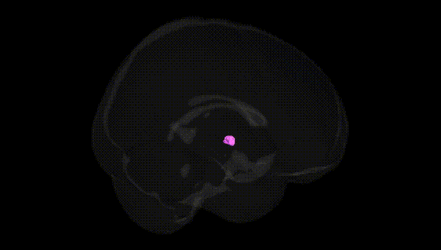 Full Brain Black