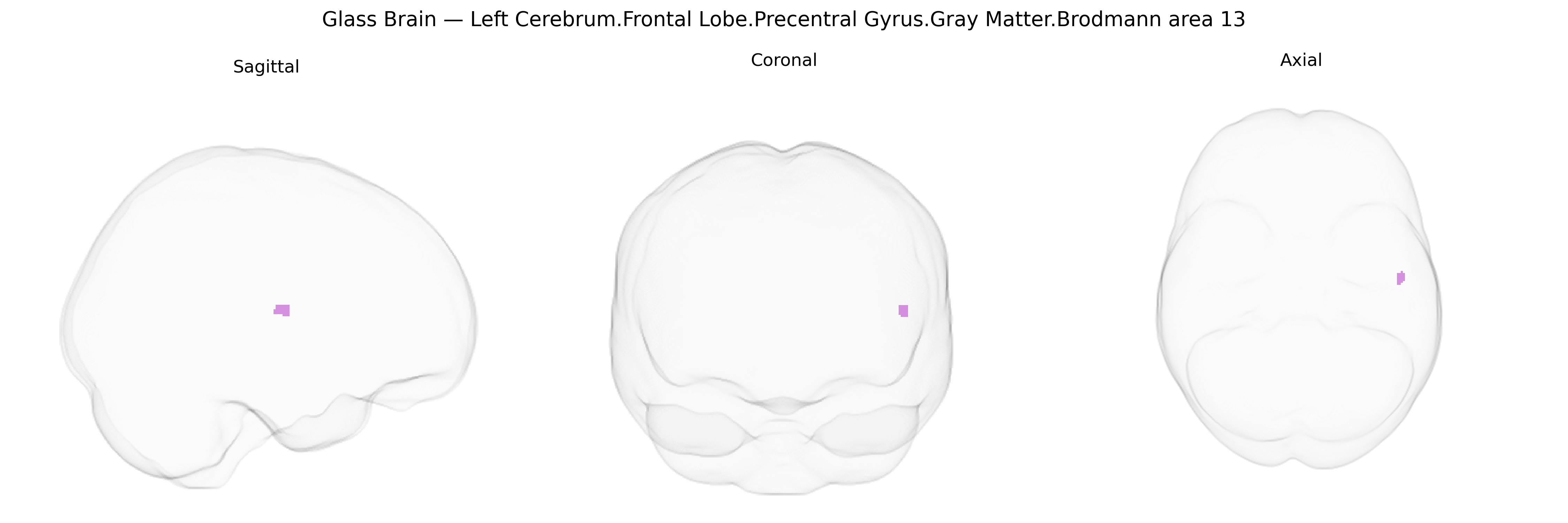 Triplanar Ghost Brain