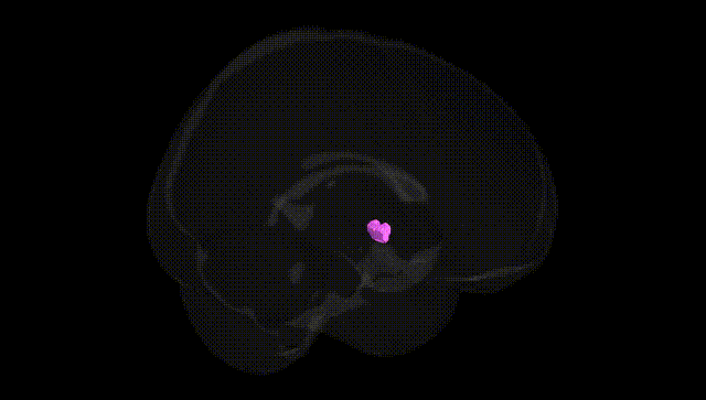 Full Brain Black