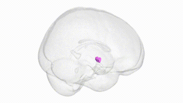 Full Brain White