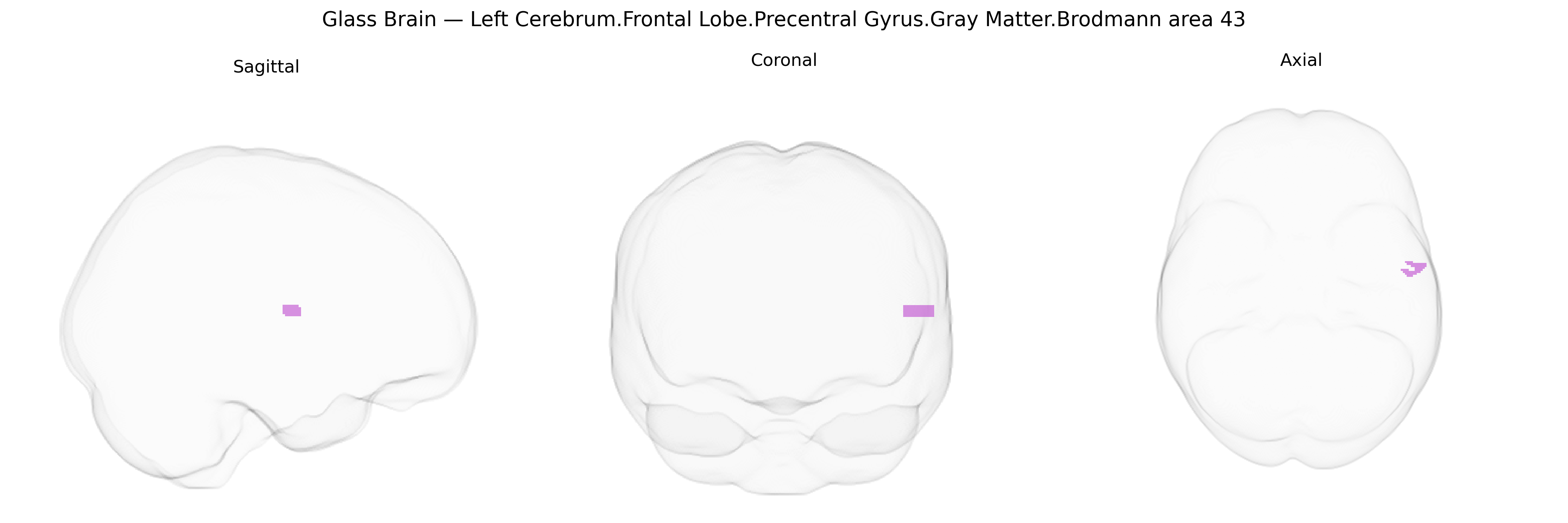 Triplanar Ghost Brain