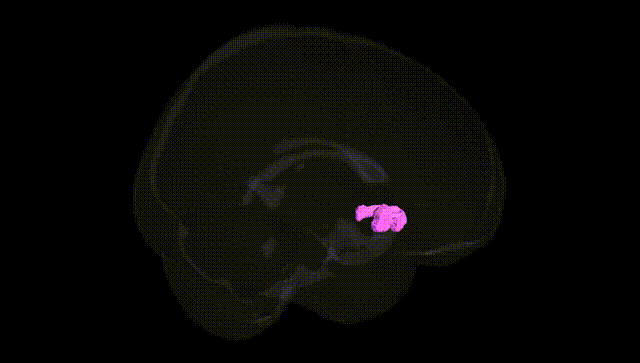 Full Brain Black