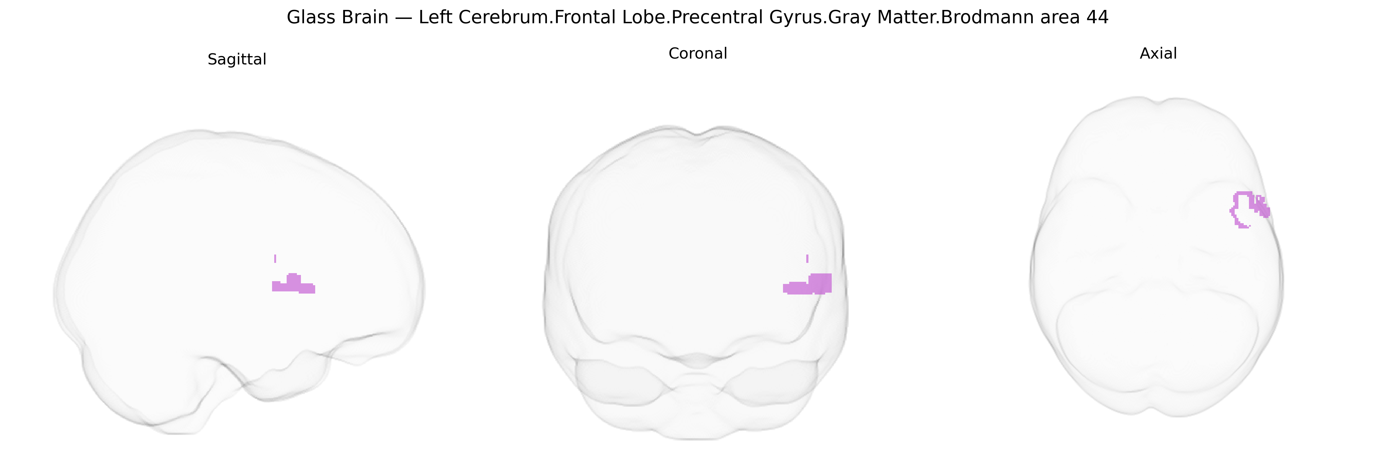 Triplanar Ghost Brain