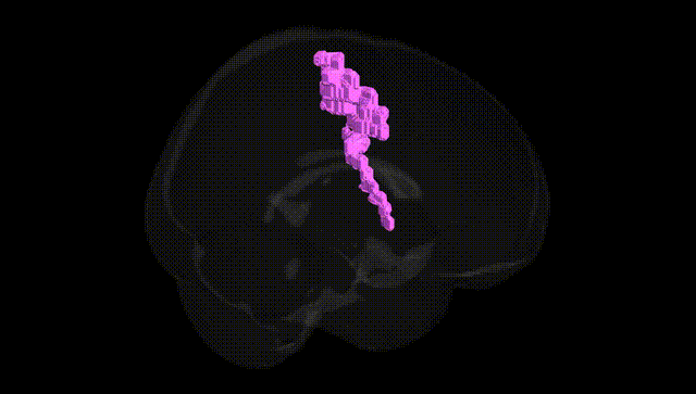Full Brain Black