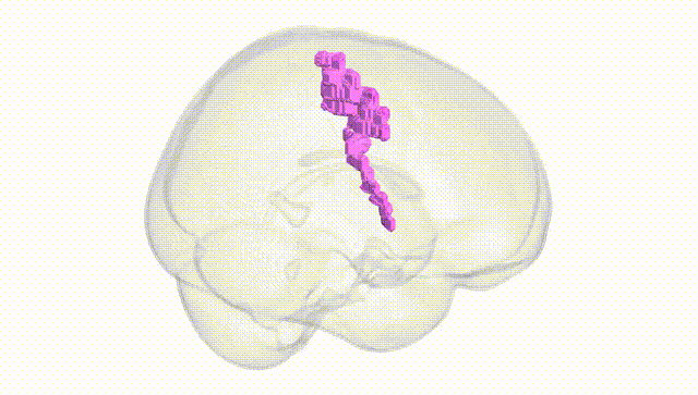 Full Brain White